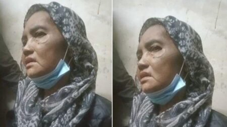 Janda Tua Asal Aceh Timur Mengalami Sakit Ginjal Stadium 3 di Malaysia, Tinggal Sebatang Kara