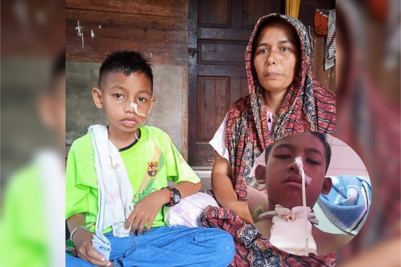 Penyakit laringitis Renggut Suara Merdu Muzammil