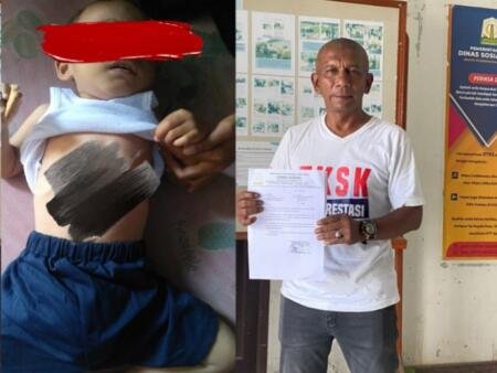 Tim Sentra Insyaf Lagi-Lagi Bantu Fasilitasi Balita Sakit Jantung di Aceh Timur