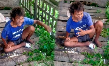 Tak Bisa Jalan, ODGJ Ini Lumpuh Ditabrak Pengendara Sepmor di Aceh Timur