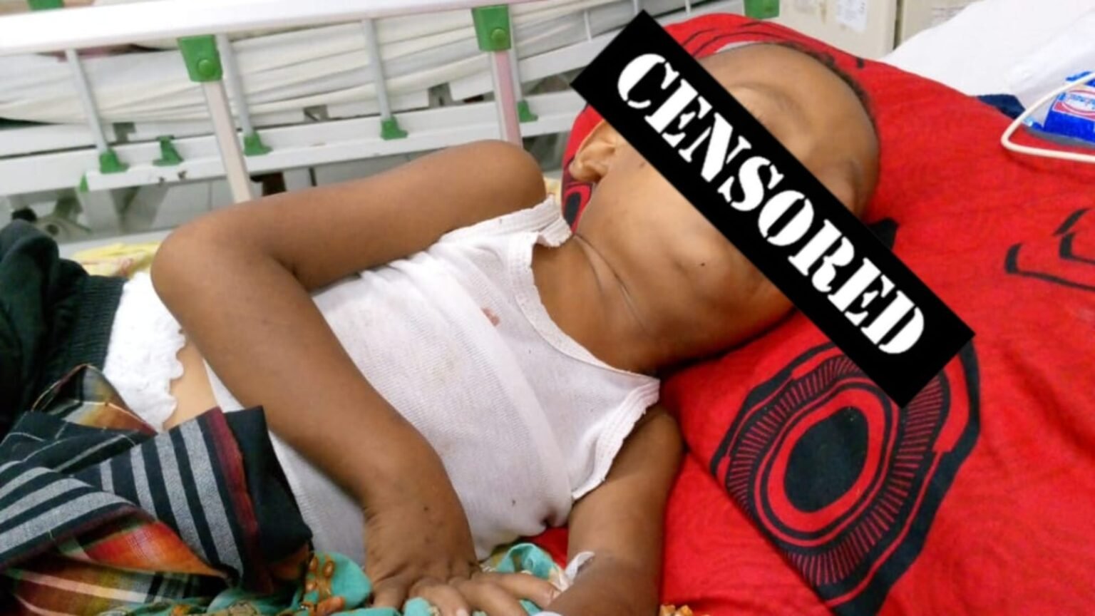 Al Karim Bocah 4 Tahun di Aceh Timur Didera Penyakit Bertubi-Tubi, Belum Dapat Bantuan