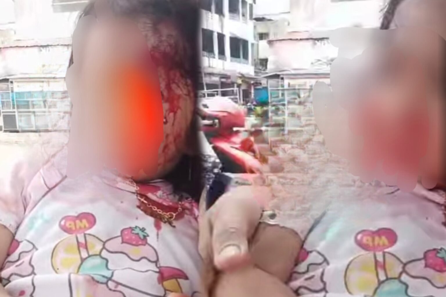 Anak Kecil di Langsa Diduga Jadi Korban Serangan ODGJ