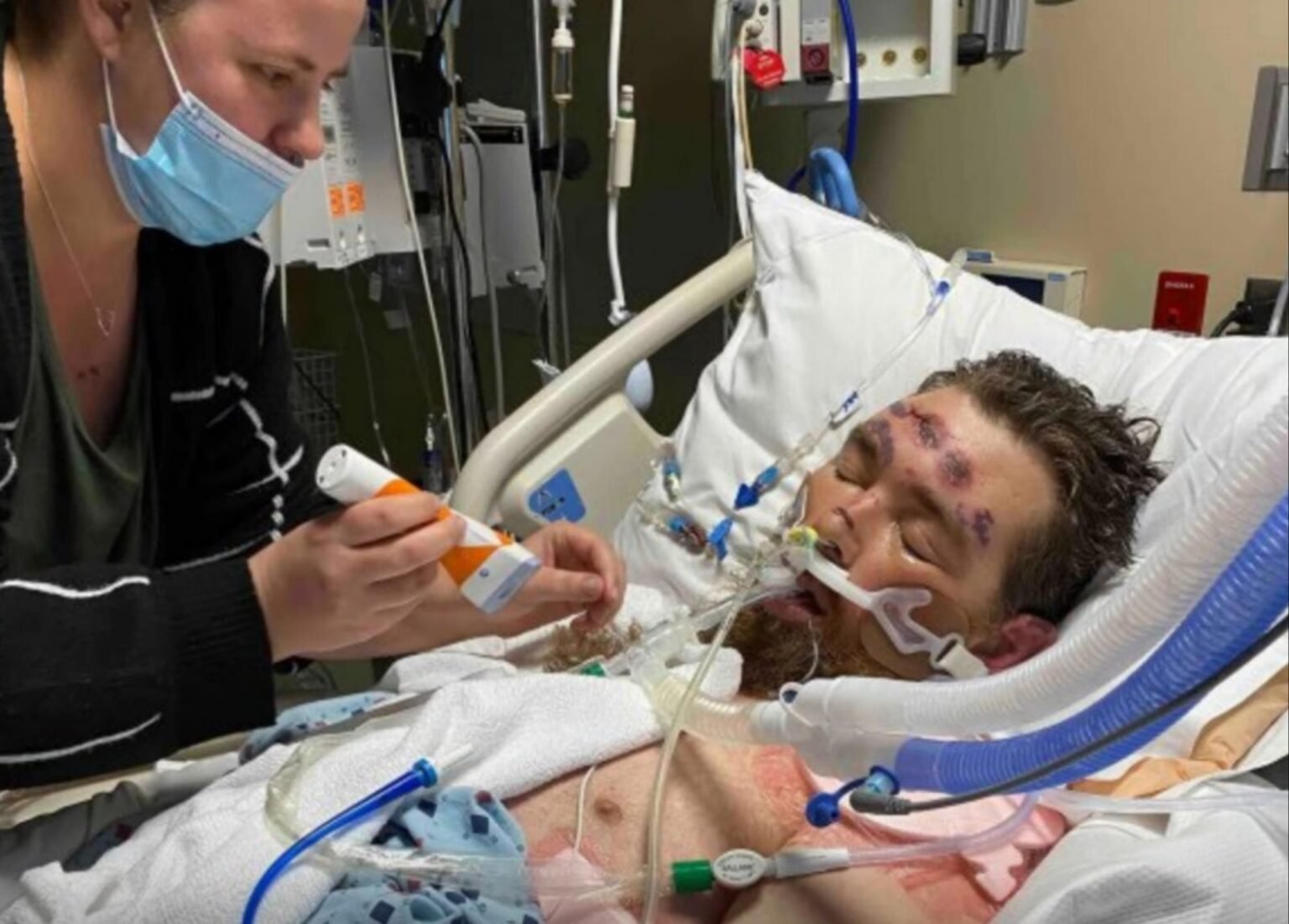 Kisah Nyata, Cabut Rambut Kemaluan, Pria Pria Asal Amerika Serikat Alami Infeksi hingga Koma