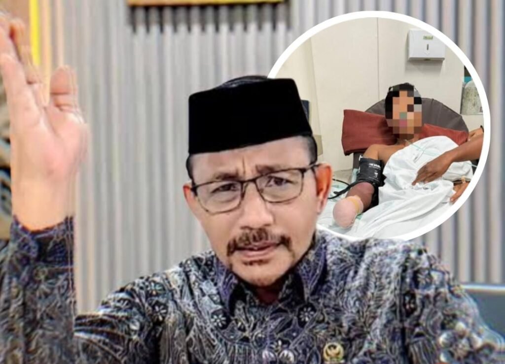 Haji Uma Bantu Biaya Makan Keluarga Korban Putus Tangan di Aceh Besar, Desak Polda Usut Tuntas