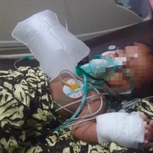 Haru! Bayi 9 Bulan Asal Julok Derita Bocor Jantung, Keluarga Mohon Uluran Tangan Dermawan